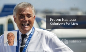 Men's hair replacement Burlington Vermont